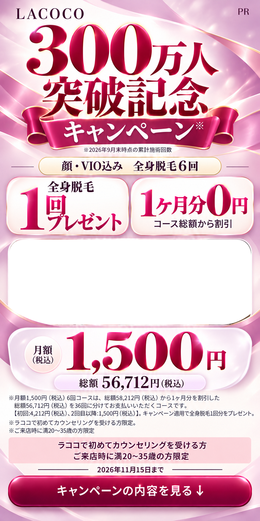 LACOCO 300万人突破記念キャンペーン。顔・VIO込み全身脱毛6回。全身脱毛1回プレゼント、1ヶ月分0円。月額1,500円、総額56,712円。対象条件・料金注記は画像内に記載。